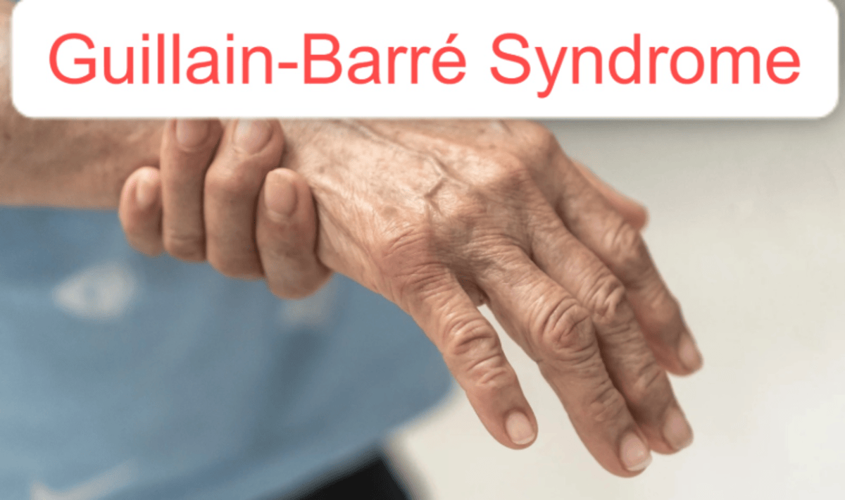 Pune GBS Guillain-Barre Syndrome